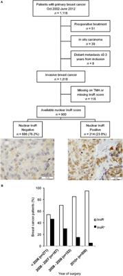 Body Mass Index Influences the Prognostic Impact of Combined Nuclear Insulin Receptor and Estrogen Receptor Expression in Primary Breast Cancer